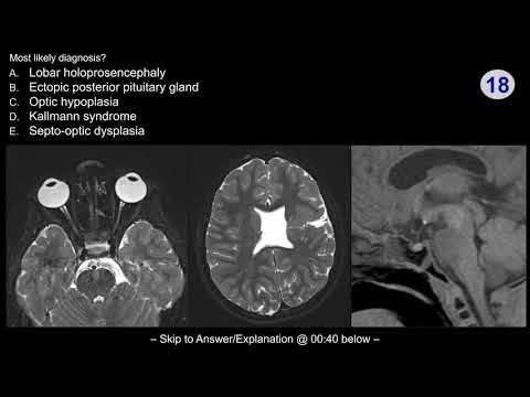 Neuroradiology board review - Pediatric Case 1