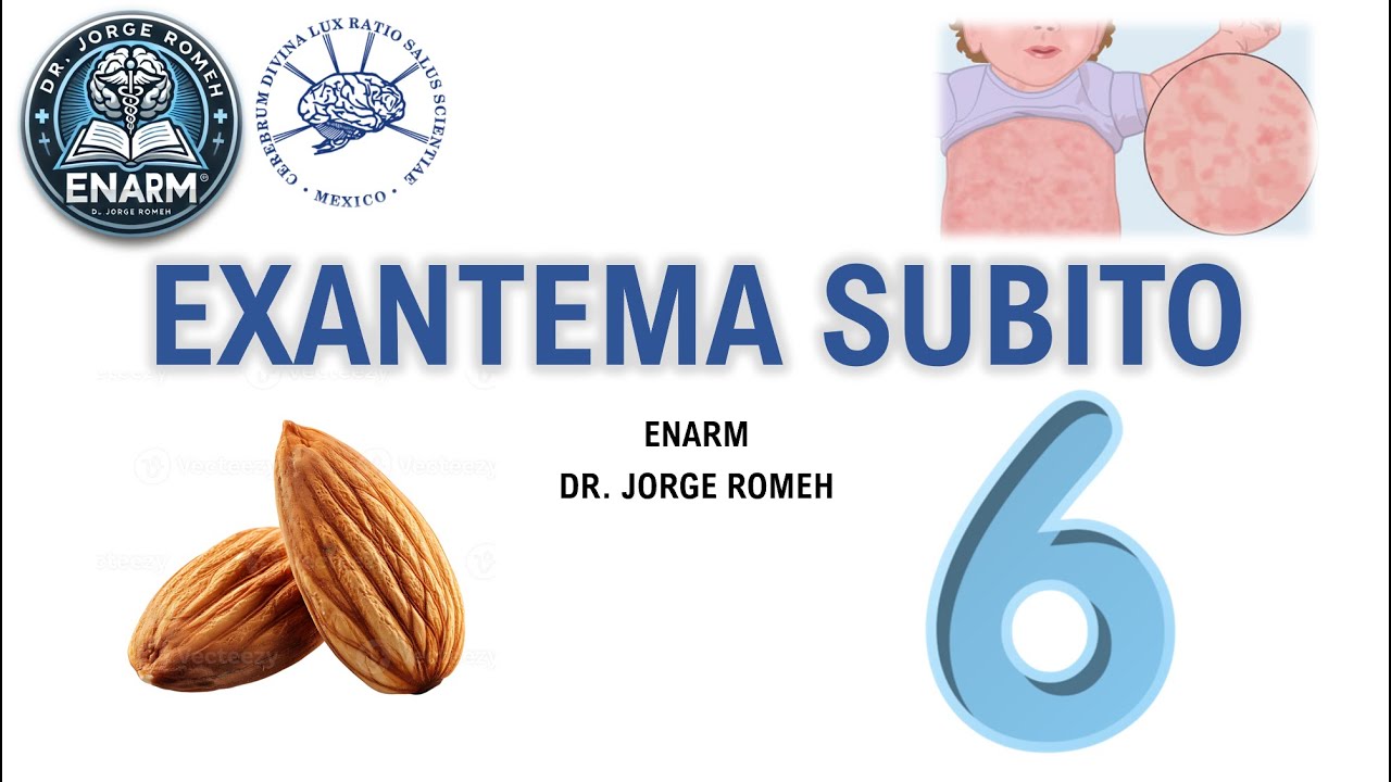 EXANTEMA SUBITO (ENF. EXANTEMATICAS) - ENARM - TODO LO QUE DEBES SABER