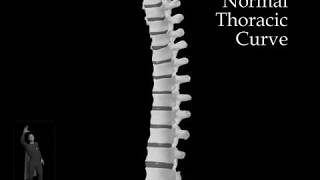 Normal Thoracic Curve