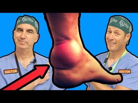 Achilles Tendinitis: Causes and Treatments