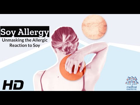 Wheat Allergy Causes Signs and Symptoms Diagnosis and Treatment