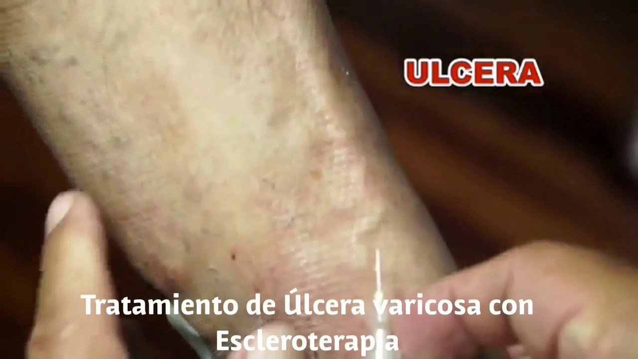 David F. Corrales Sánchez-14