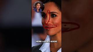 Meghan Markle Plastic Surgery Analysis