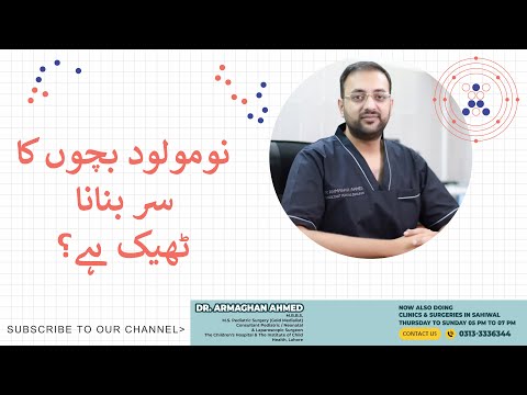 Is it okay to shape up a newborn baby's head or not?