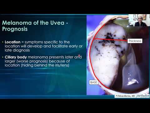 AANP Teaching Rounds - January 23, 2023 - Ocular Pathology: Uveal melanoma, Retinoblastoma, Cataract