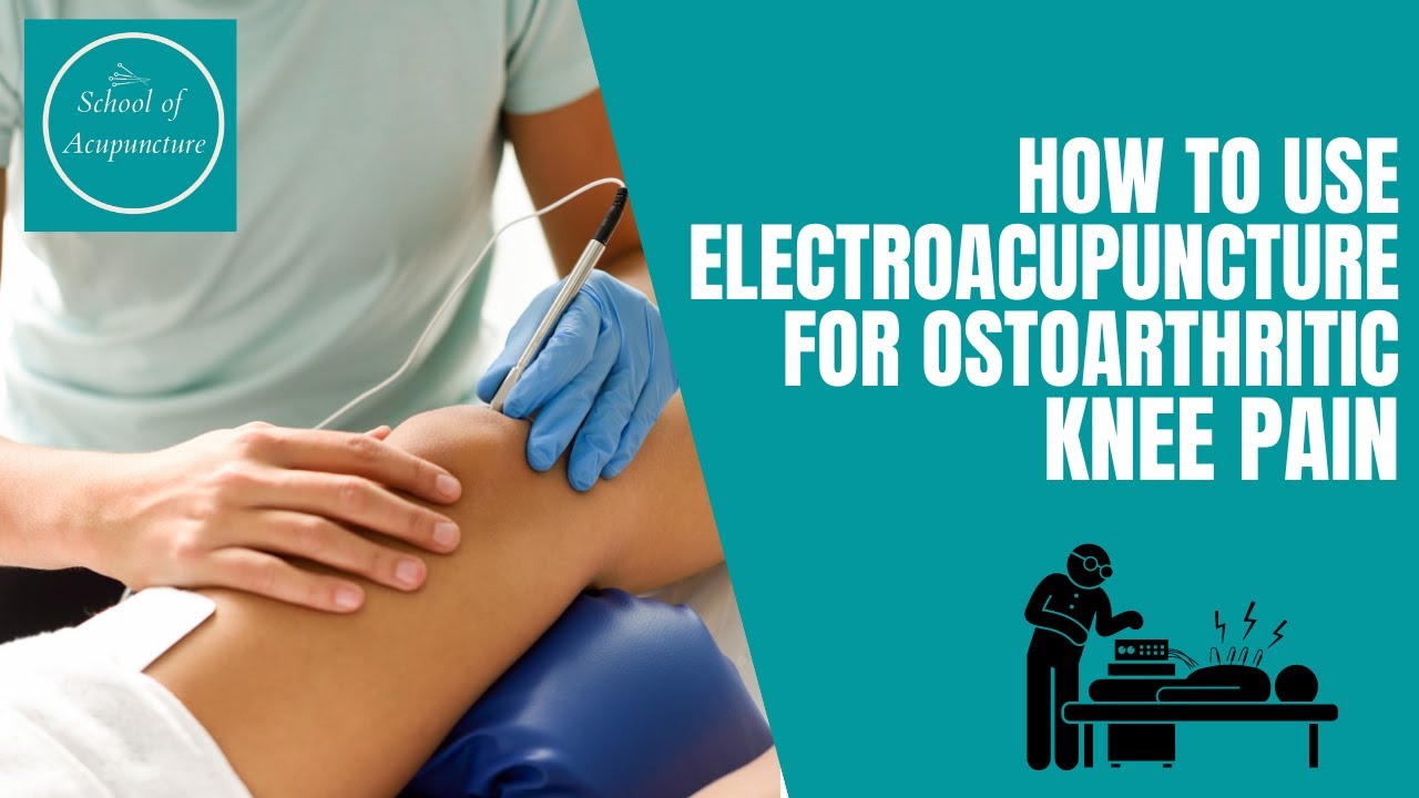 How to use electroacupuncture for the management of osteoarthritic knee pain - YouTube