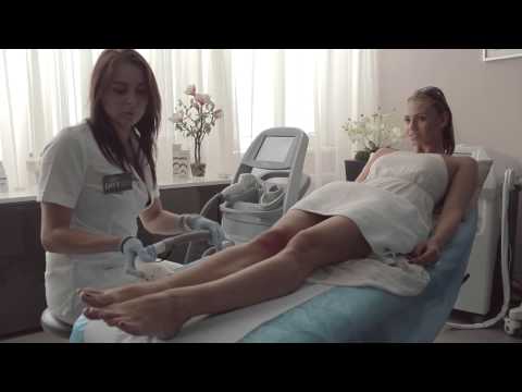 ENVY krása - Epilácia laserom Lightsheer Duet