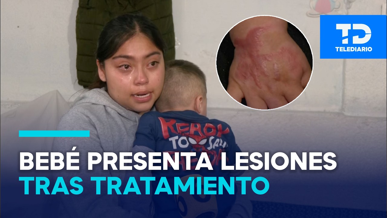 Dylan, de 1 año, sufre severas lesiones por tratamiento en hospital de Tacubaya