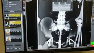 Pacific X-ray Technologies demonstrates Image Suite software