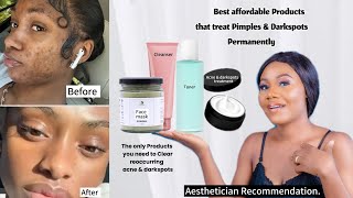 SKINCARE PRODUCTS THAT REMOVES CHRONIC DARKSPOTS & PIMPLES #skincare #skincarereview