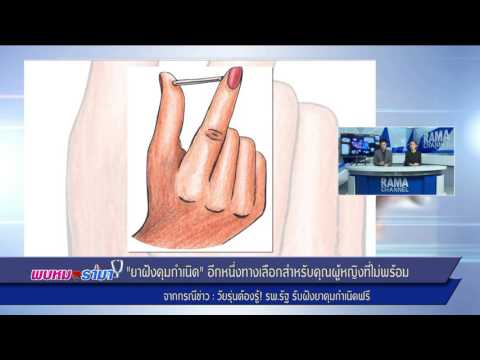 Oleoresin ซีดาร์จากโรคสะเก็ดเงิน ชีวิตเพศของโรคสะเก็ดเงิน