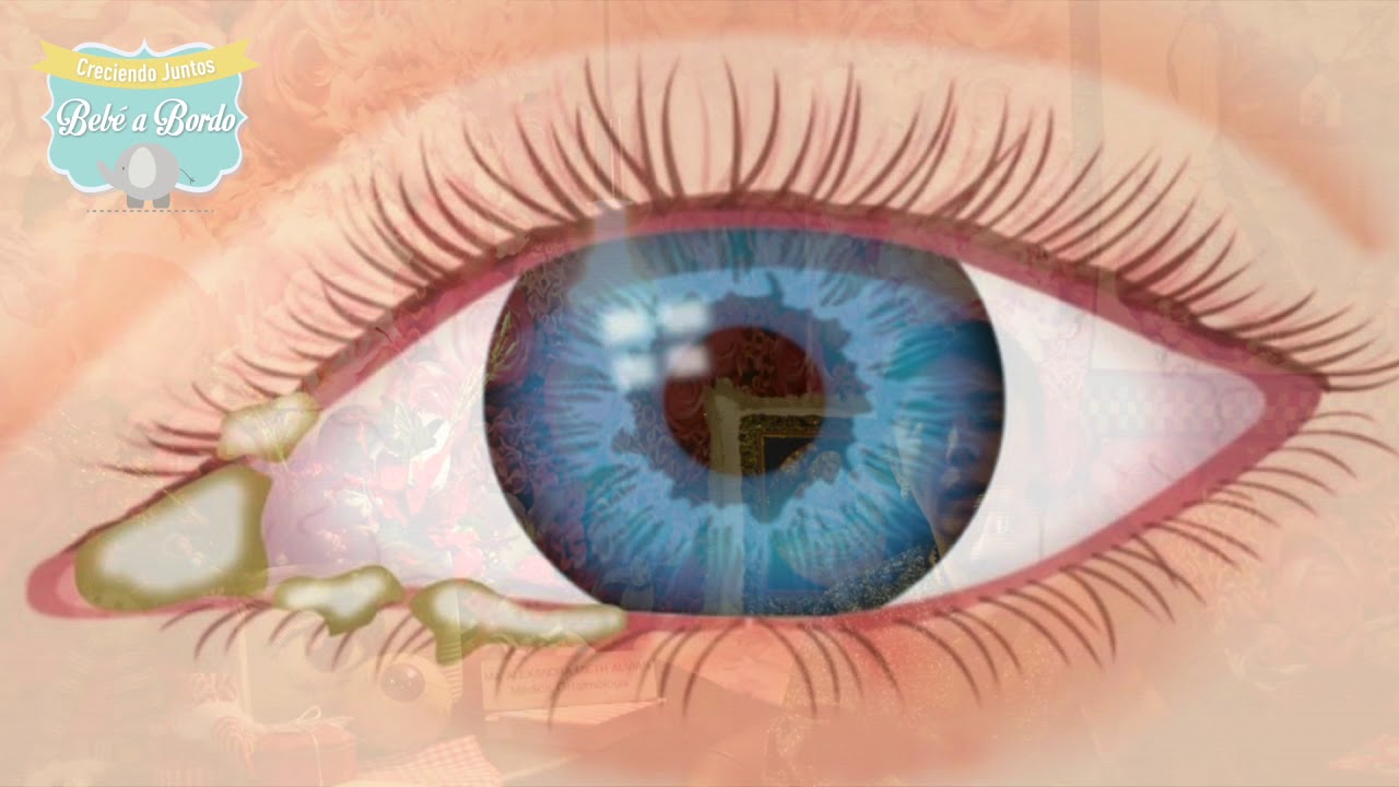 ¿Qué es y que significa la lagaña en los ojos