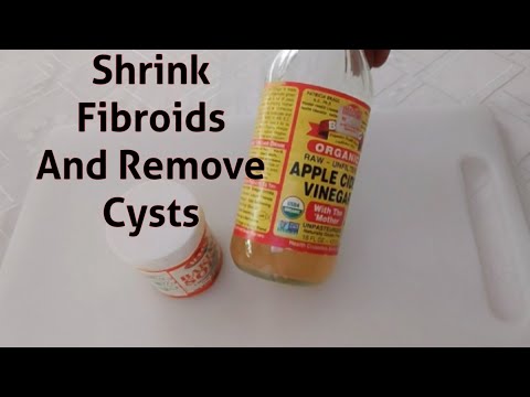, title : 'Shrink Fibriod And Remove Cysts Naturally with just 2 kitchen ingredients'