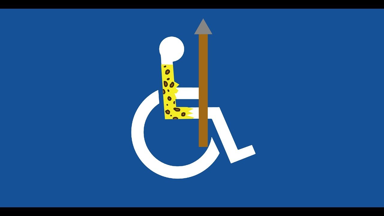 Disabilities in Prehistory