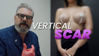Fear of Vertical Scars Let’s Talk Breast Lift & Implant Healing