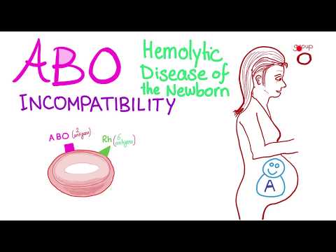 ABO Incompatibility - Hemolytic Disease Of The Newborn (HDN) - Hematology & Pathology