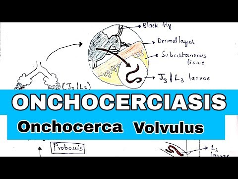 TAENIA tenia SOLIUM BY PHANINDRA GUPTHA