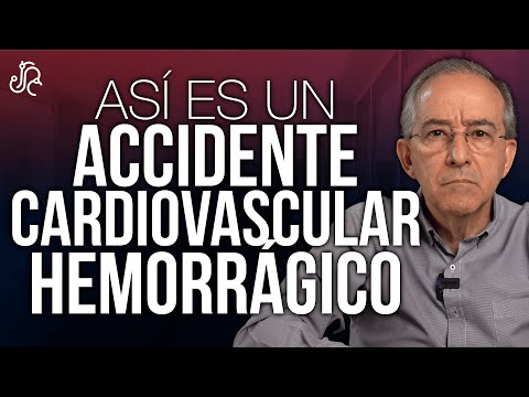 Cómo Es Un Accidente Cerebro Vascular Hemorrágico ? - Oswaldo Restrepo RSC