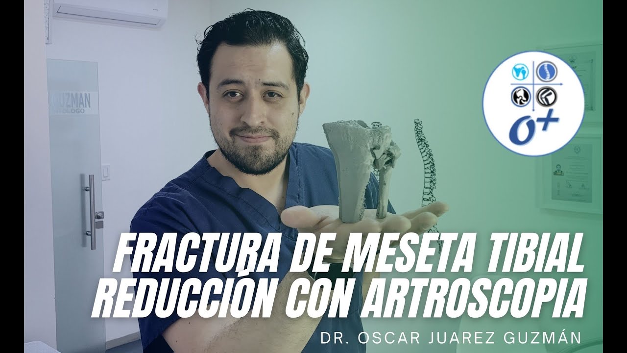 Óscar Omar Juárez Guzmán-14