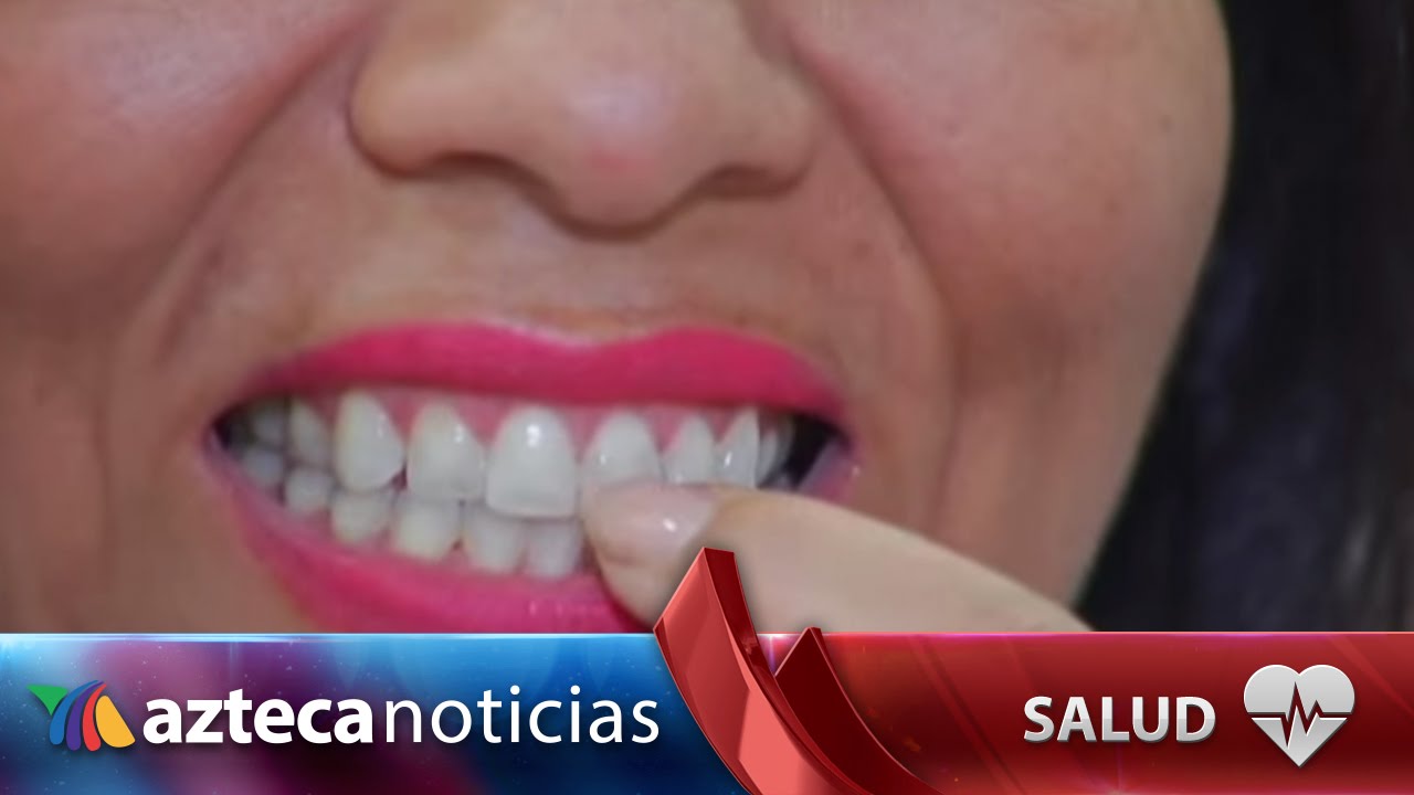 ¿Puntos blancos en la boca Puede ser cáncer