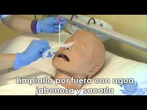 Cambio de sonda nasogástrica