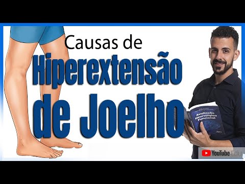 Hiperextensão de Joelho Pós-AVC - Rogério Souza