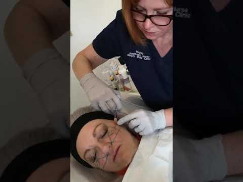 Live Demo: Teosyal Dermal Filler for the Mid Face