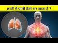 छाती में पानी कैसे भर जाता हैं Fluid Accumulation In