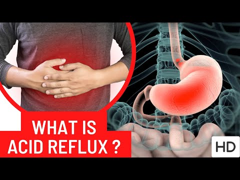 Hepatitis Causes Signs and Symptoms Diagnosis and Treatment