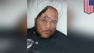 Unarmed man who lost part of his skull in Los Angeles police shooting sues for damages - TomoNews