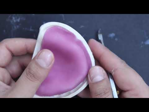 Lab 1 fabrication of maxillary and mandibular custom tray