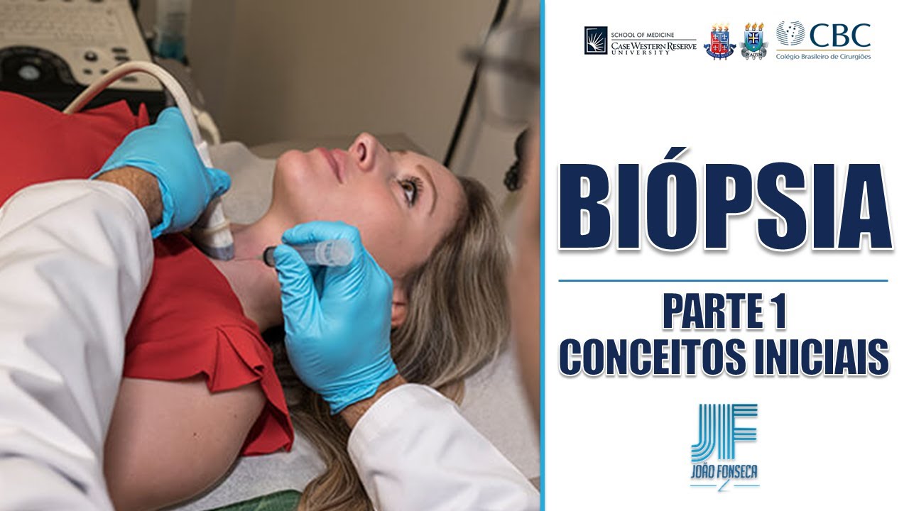 BIÓPSIA (Parte 1): Conceitos Iniciais 👨🏽‍⚕‍🚑 Joao Fonseca (Cirurgia Geral)