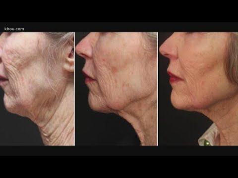 Facelift without surgery? Yes, it's possible, doctors say