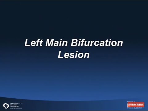 Left Main Bifurcation Lesion