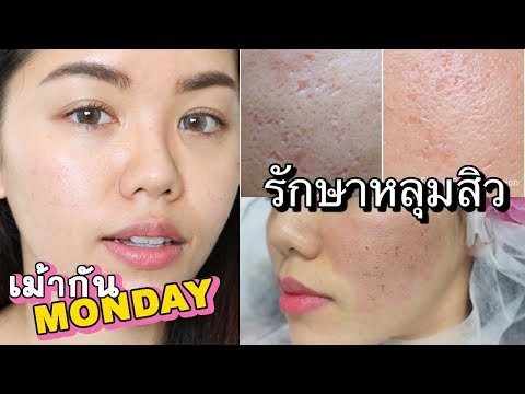 Tera ออนไลน์ enlarge หน้าอก ทบทวนคลิกเพื่อขยายหน้าอก