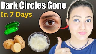 Remove *Dark Circles* Spots, Puffy Eyes Permanently in 2 Weeks | DIY Home Remedy, 100% Results