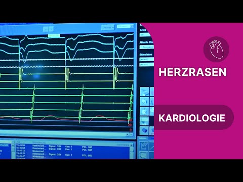 Was passiert bei anfallsweisem Herzrasen?