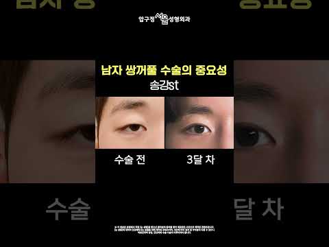 �������� �۰� ��?