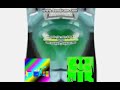 Blind KlaskyKlaskyKlaskyKlasky Gummy Bear Song Version By VideoEffects2017 HD