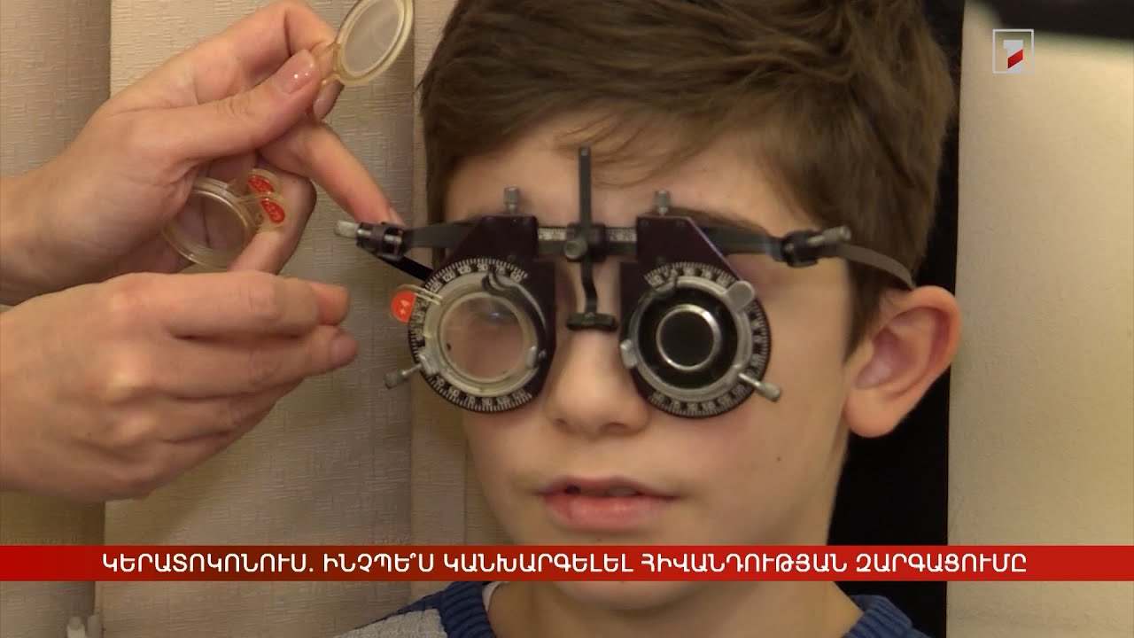 Կերատոկոնուս. ինչպե՞ս կանխարգելել հիվանդության զարգացումը