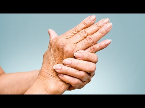 Afla totul despre artroza: Simptome, tipuri, diagnostic si tratament | gesservice.ro