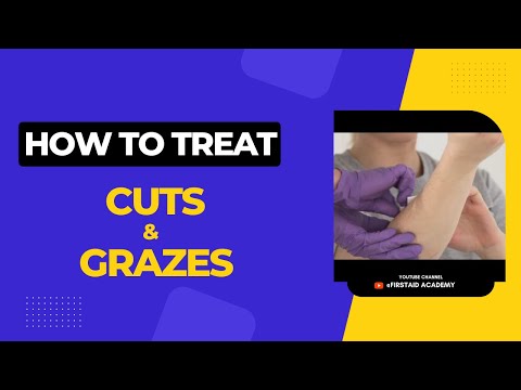 📺HOW TO TREAT CUTS AND  GRAZES
