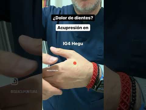 Acupresión para el dolor de dientes #acupuntura #mtc #medicinachina #acupresión #digitopuntura