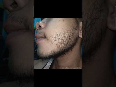 1 Month Beard Transformation | Real Minoxidil Growth Day 1→32