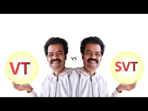 Brugada Criteria-  VT vs SVT made simple