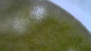 <em>Stentor pyriformis</em> Johnson, 1893