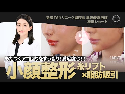 たるみが気になるアナタに!Dr.奥津の小顔術