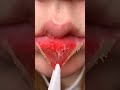 Peeling the Skin of your lips 😱😱 #shorts #lips #lipshack #peeling #satisfying