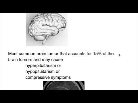 Pleomorphic adenoma treatment surgery