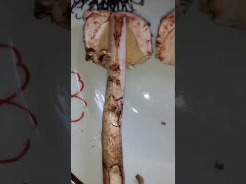 safranschirmling giftig oder nicht ist nur unter Mikroskop zu erkennen